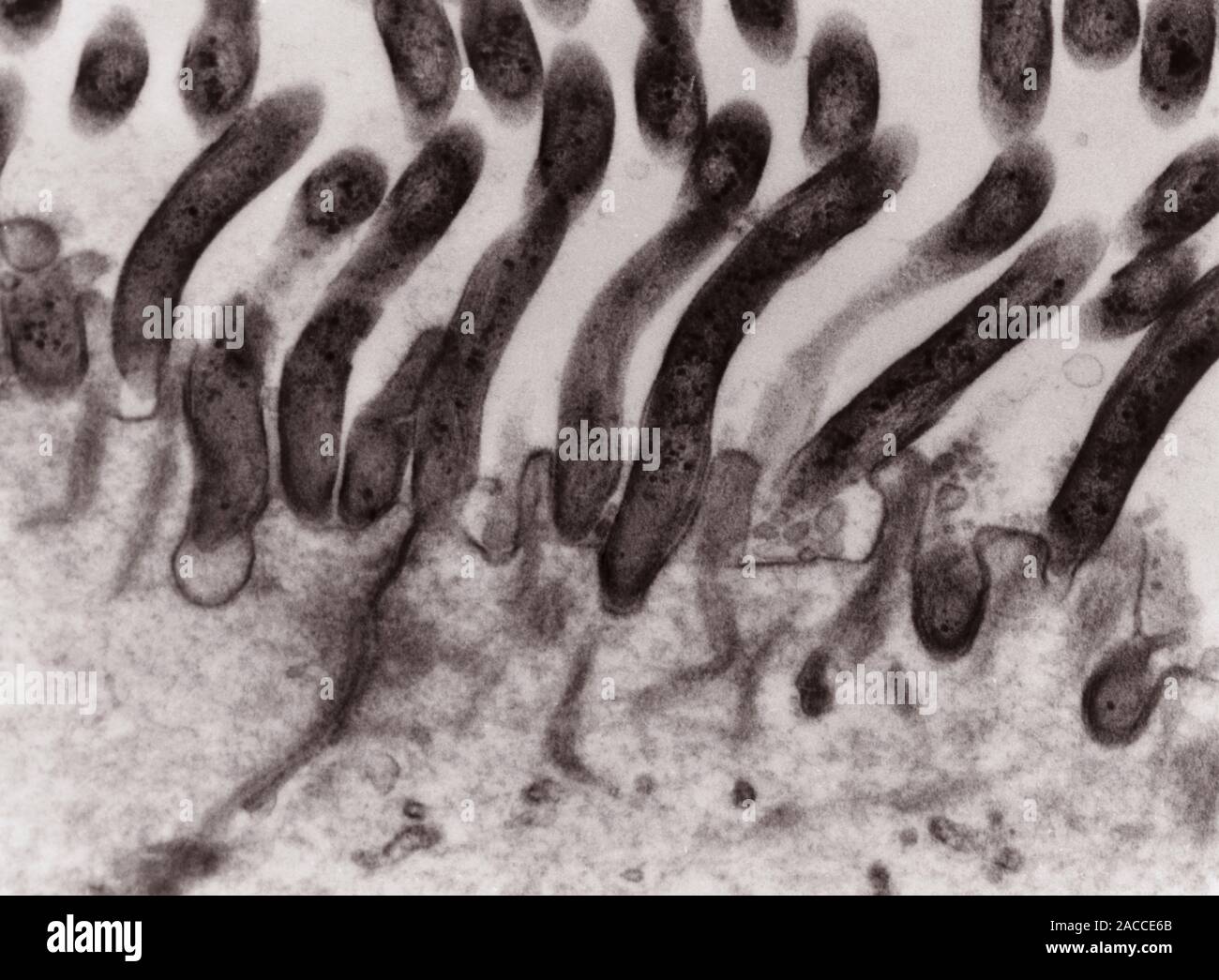 Treponema Sp Transmission Electron Micrograph Of Sectioned Treponema