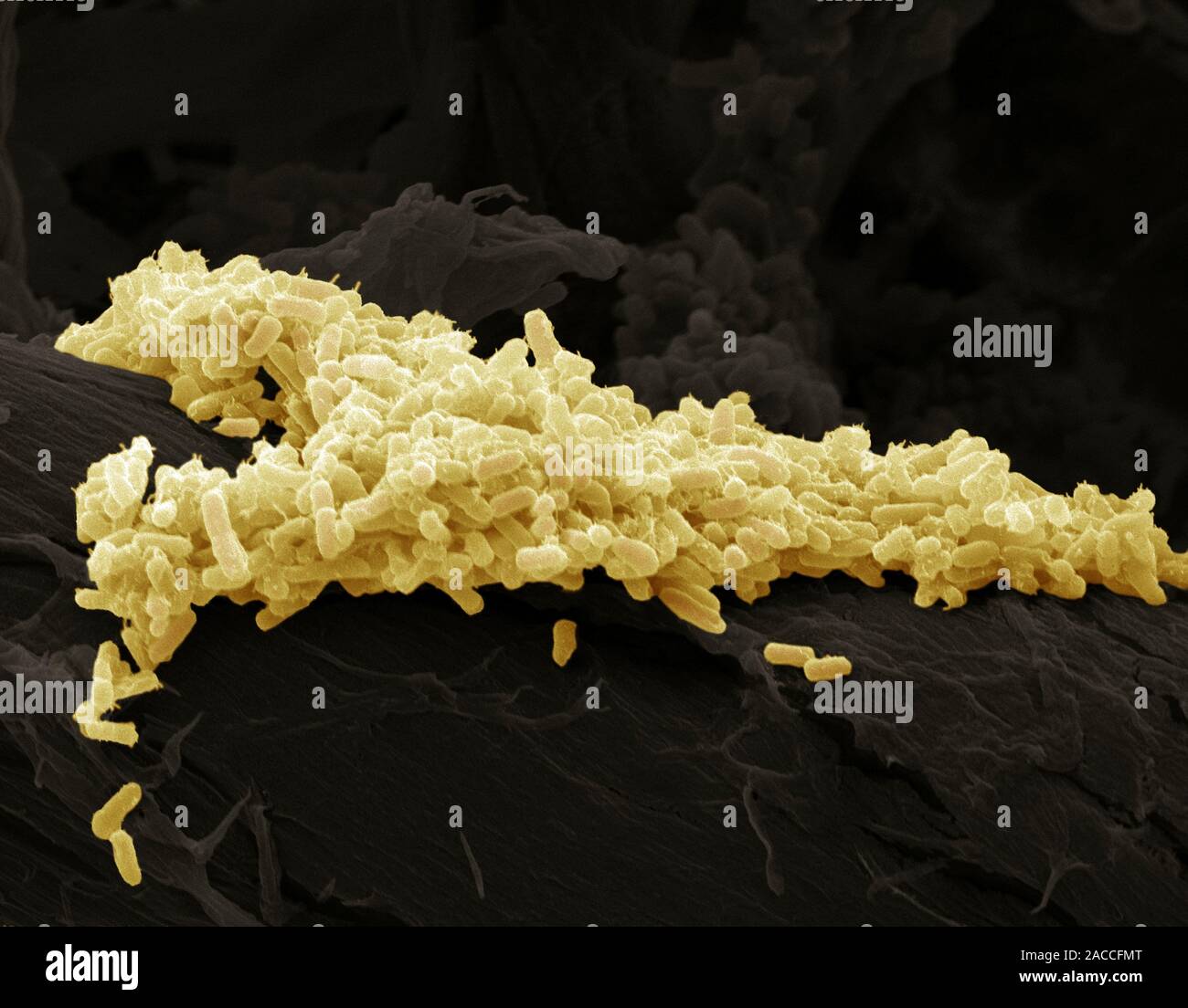 E Coli Bacteria Coloured Scanning Electron Micrograph Sem Of