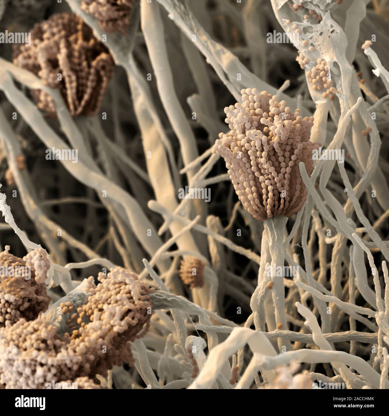 Aspergillus Fungus Coloured Scanning Electron Micrograph Sem Of The