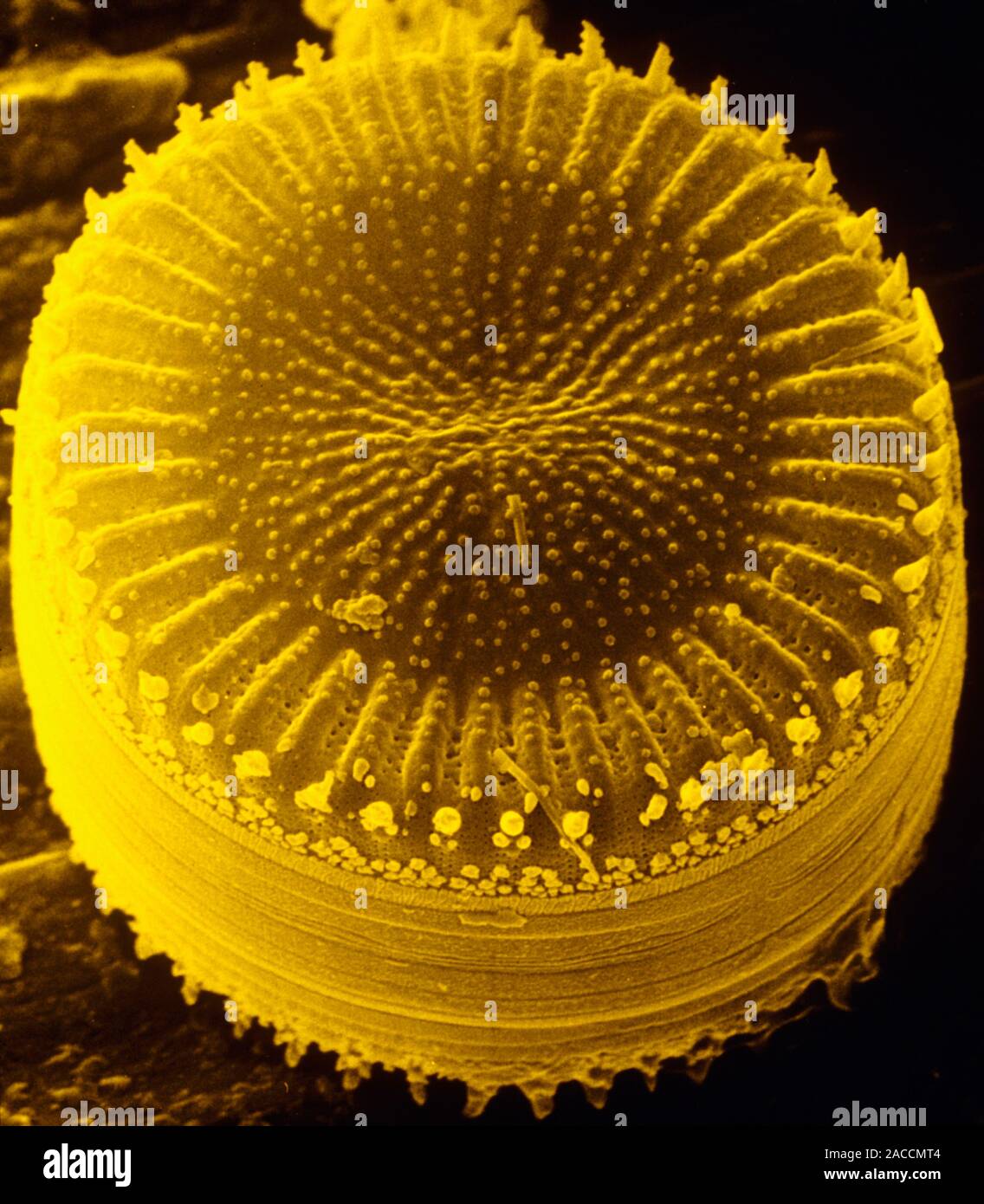 False Colour Scanning Electron Micrograph Sem Of The Centric