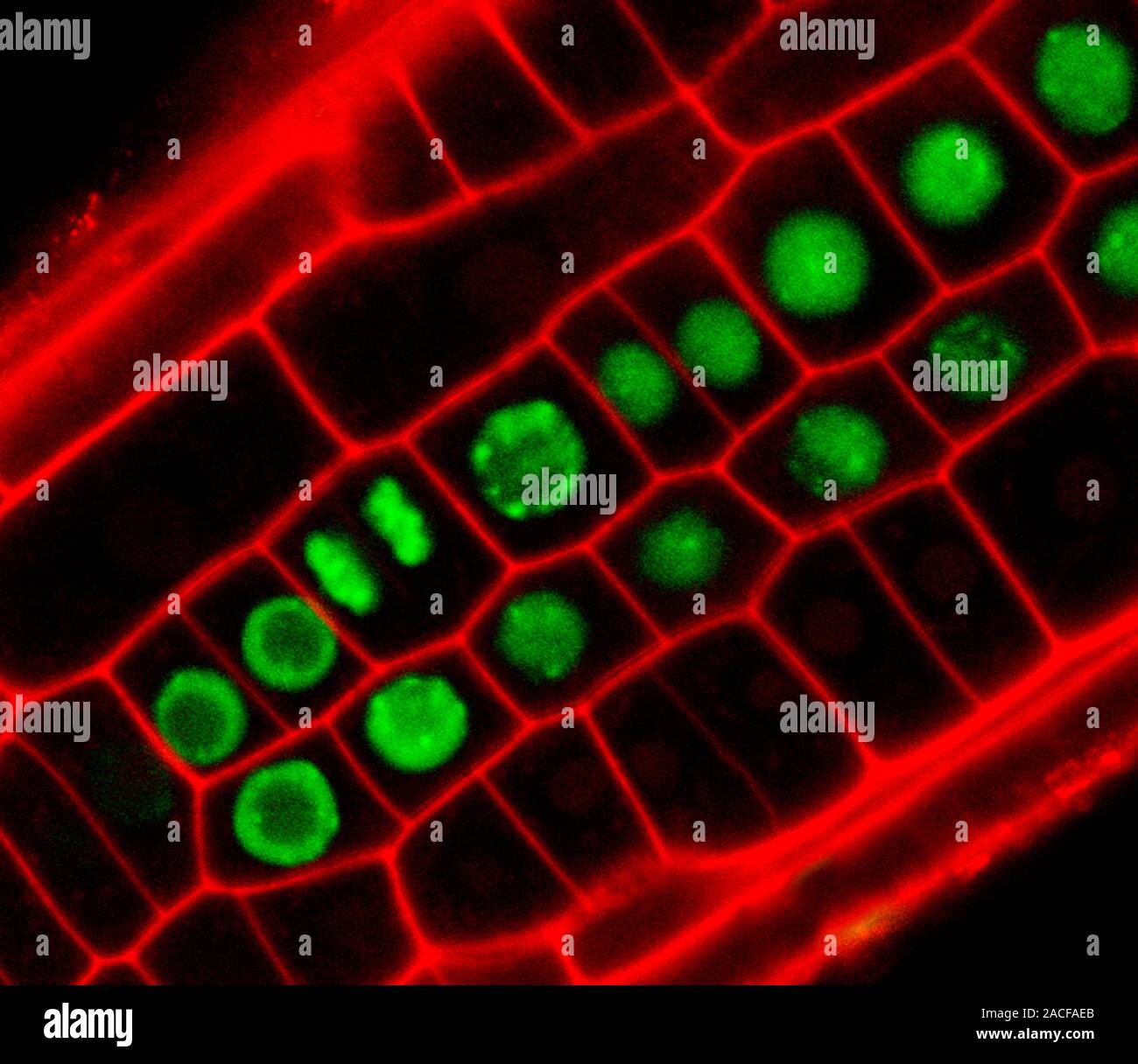 Mitosis In Plant Root Confocal Light Micrograph Showing Epidermal