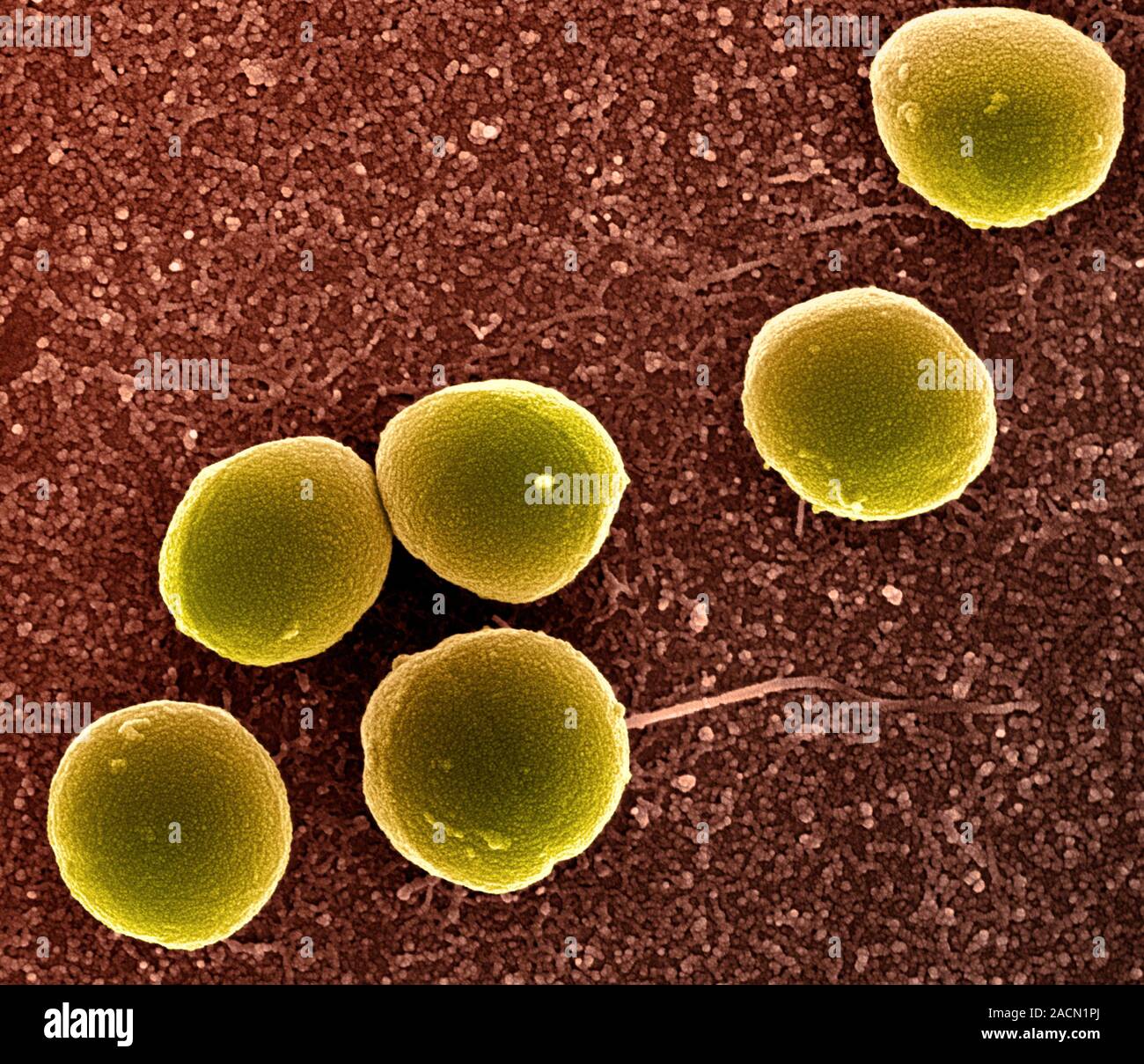 Staphylococcus Aureus Bacteria Coloured Scanning Electron Micrograph