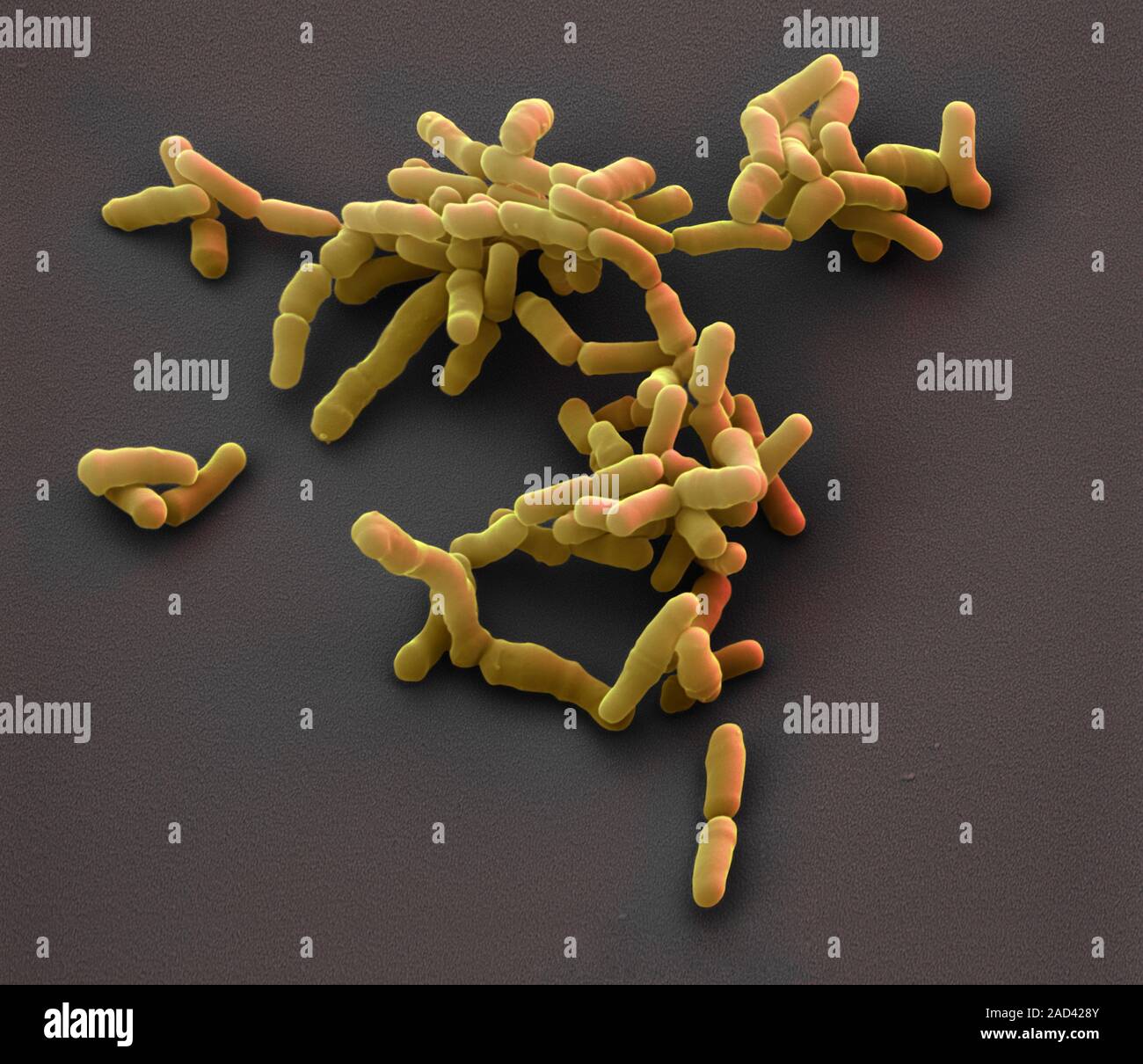 Bifidobacterium Bacteria Coloured Scanning Electron Micrograph SEM