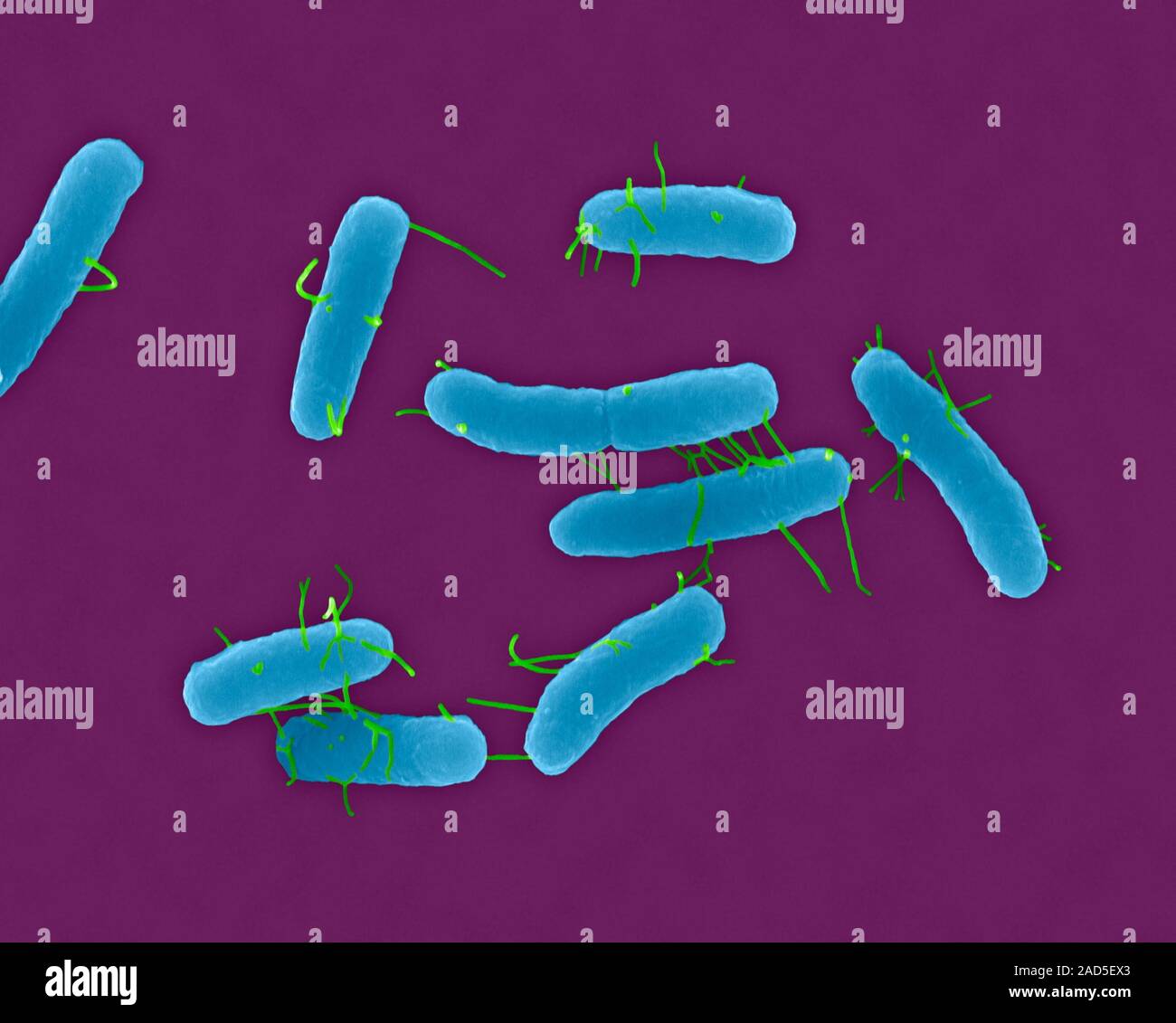 Coloured Scanning Electron Micrograph Sem Of Salmonella Typhimurium