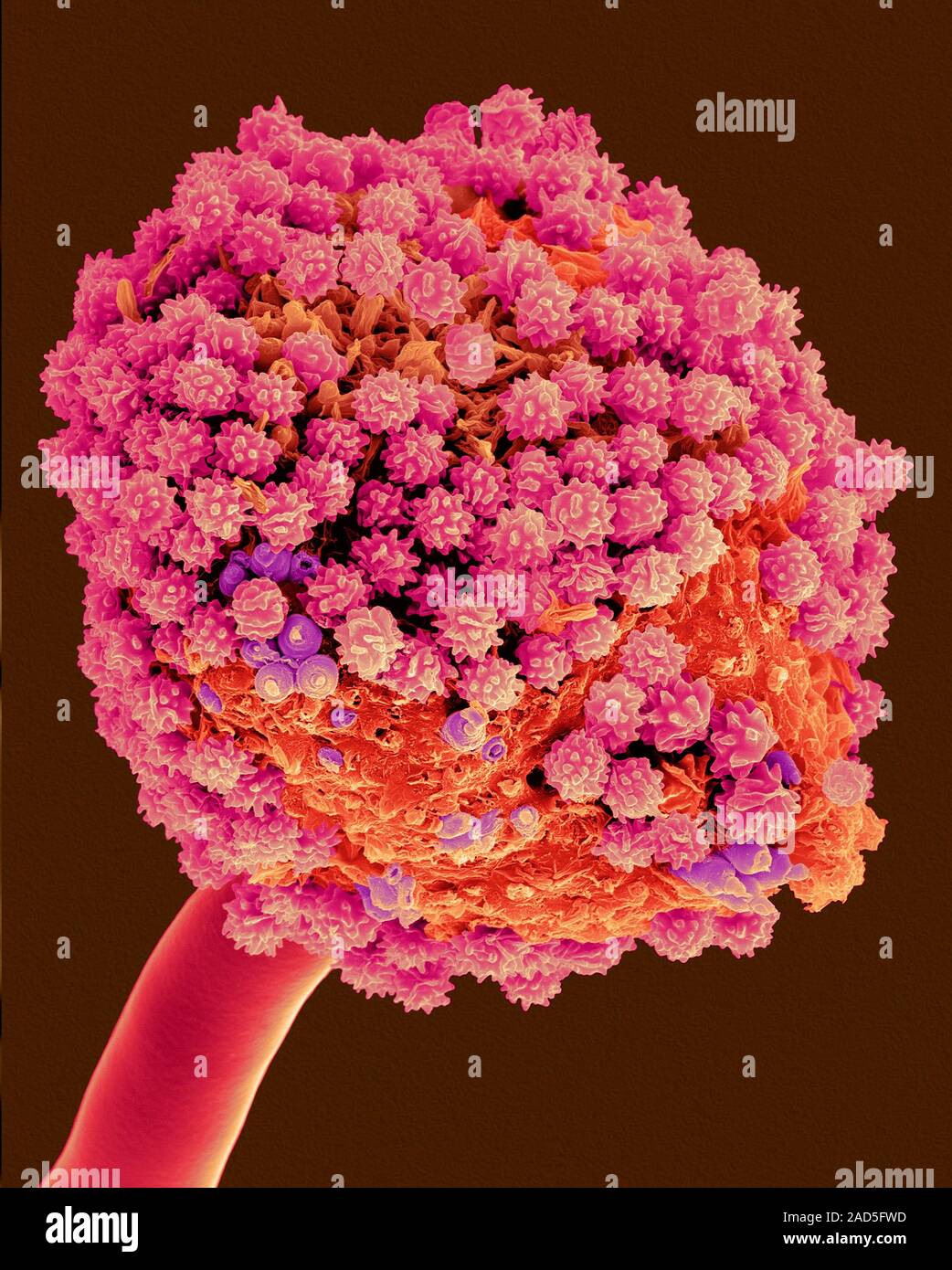 Coloured Scanning Electron Micrograph SEM Of The Black Mould