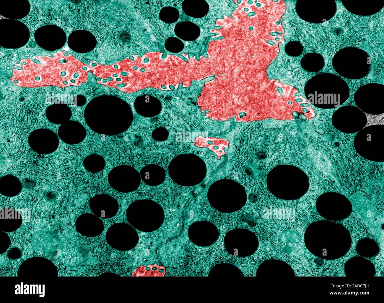 False Colour Transmission Electron Micrograph Tem Showing The Central