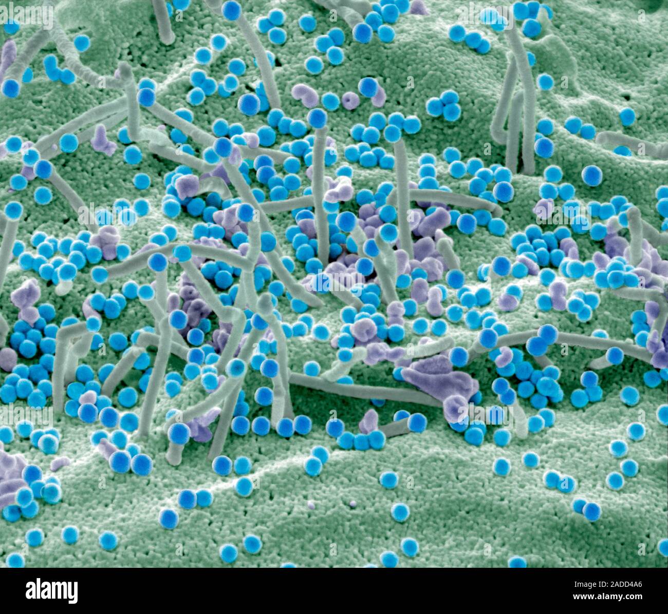 Hiv Infected T Cell Coloured Scanning Electron Micrograph Sem Of