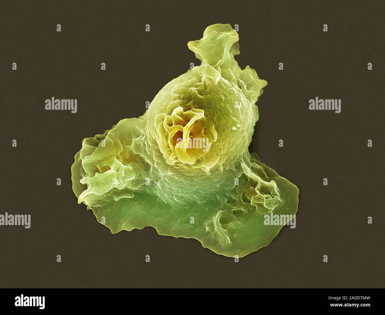 Coloured Scanning Electron Micrograph Sem Of A Neutrophil White Blood