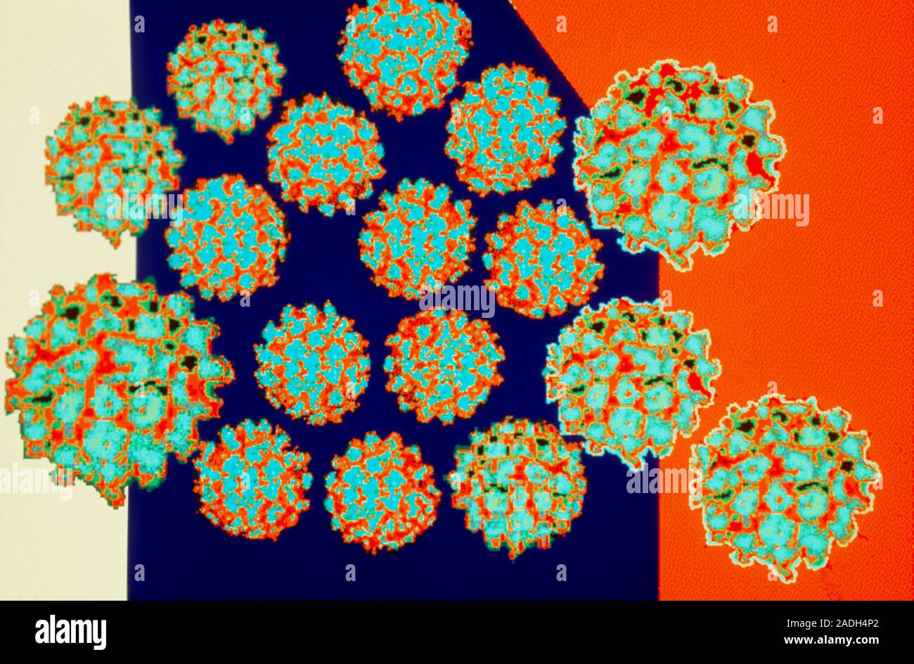 Wart Virus Coloured Transmission Electron Microg Raph Of Papilloma