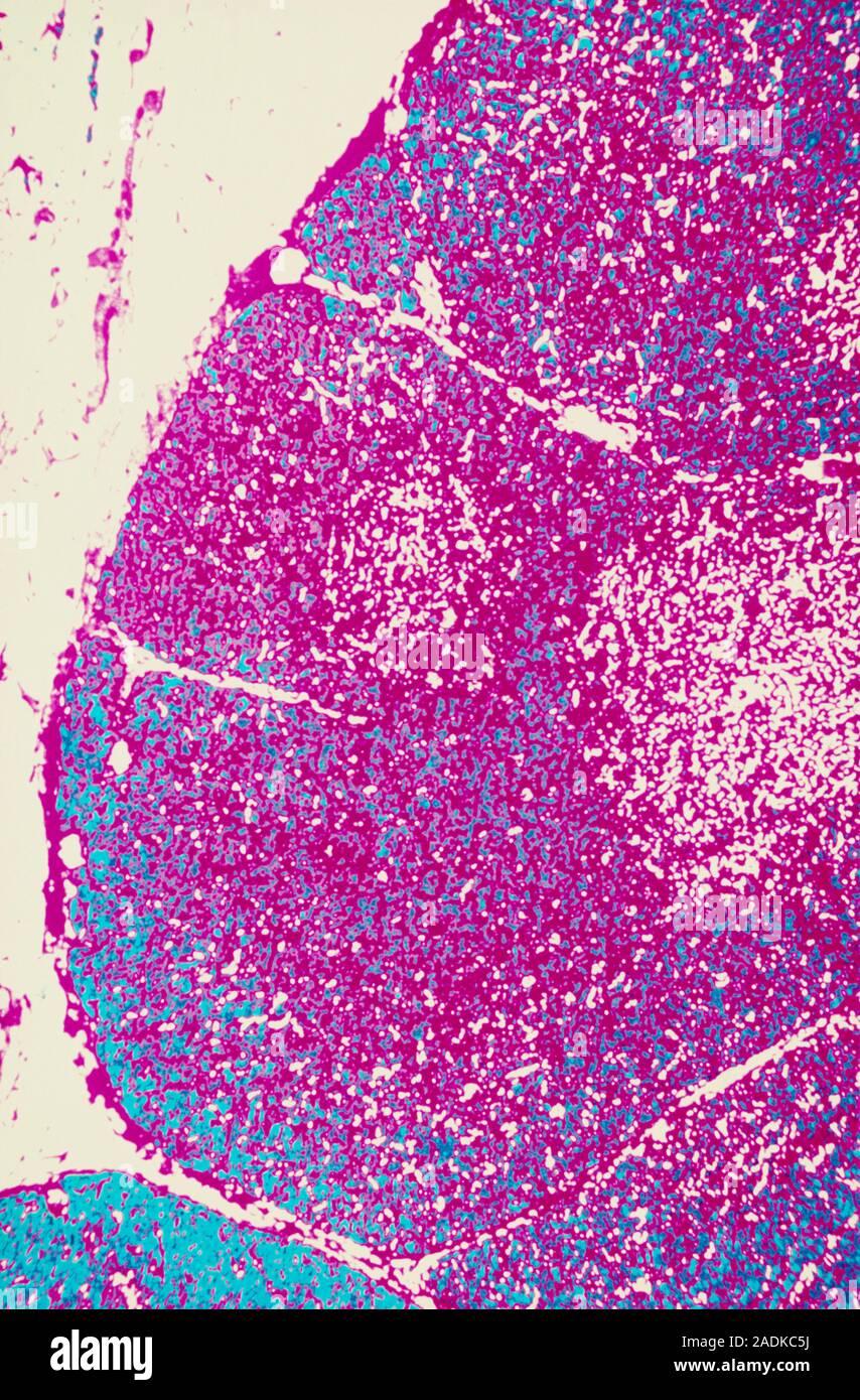 Thymus Gland Light Micrograph Of A Section Through A Healthy Human