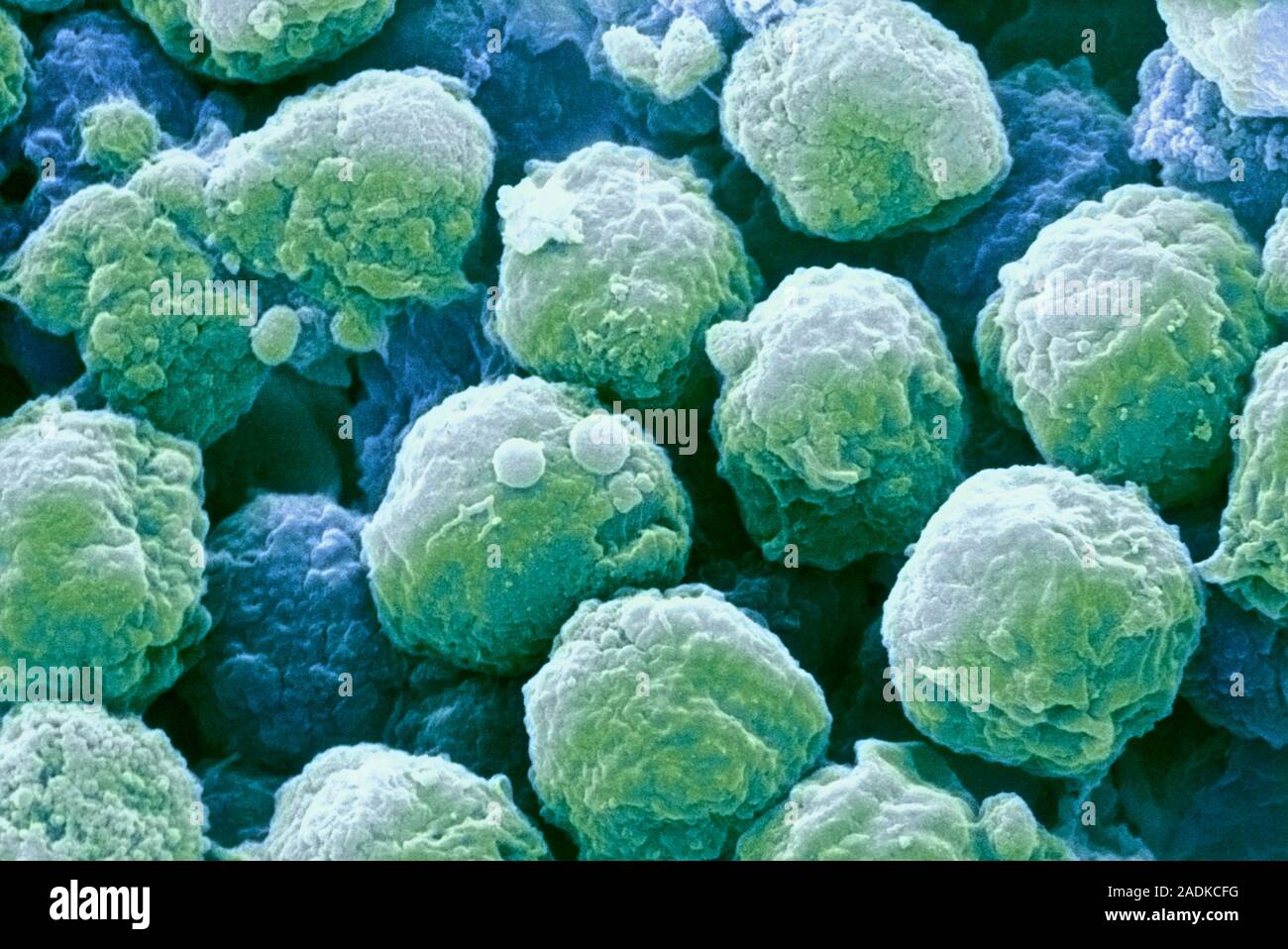 Neutrophils Coloured Scanning Electron Micrograph SEM Of Neutrophils