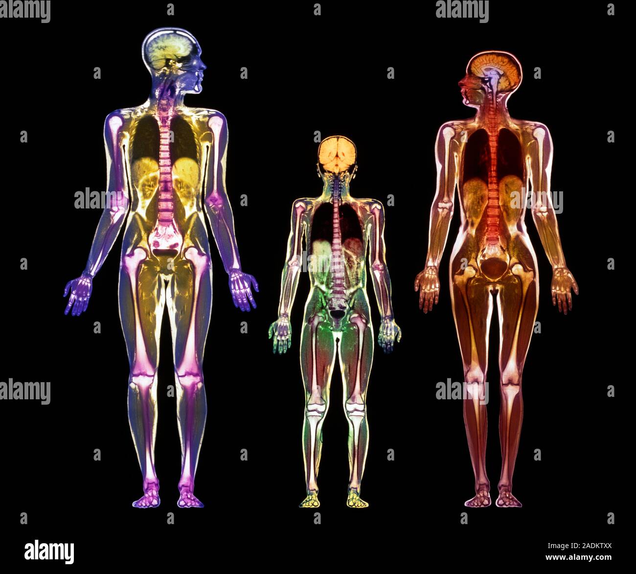 Whole Body Scans Coloured Magnetic Resonance Imaging Mri Whole Body