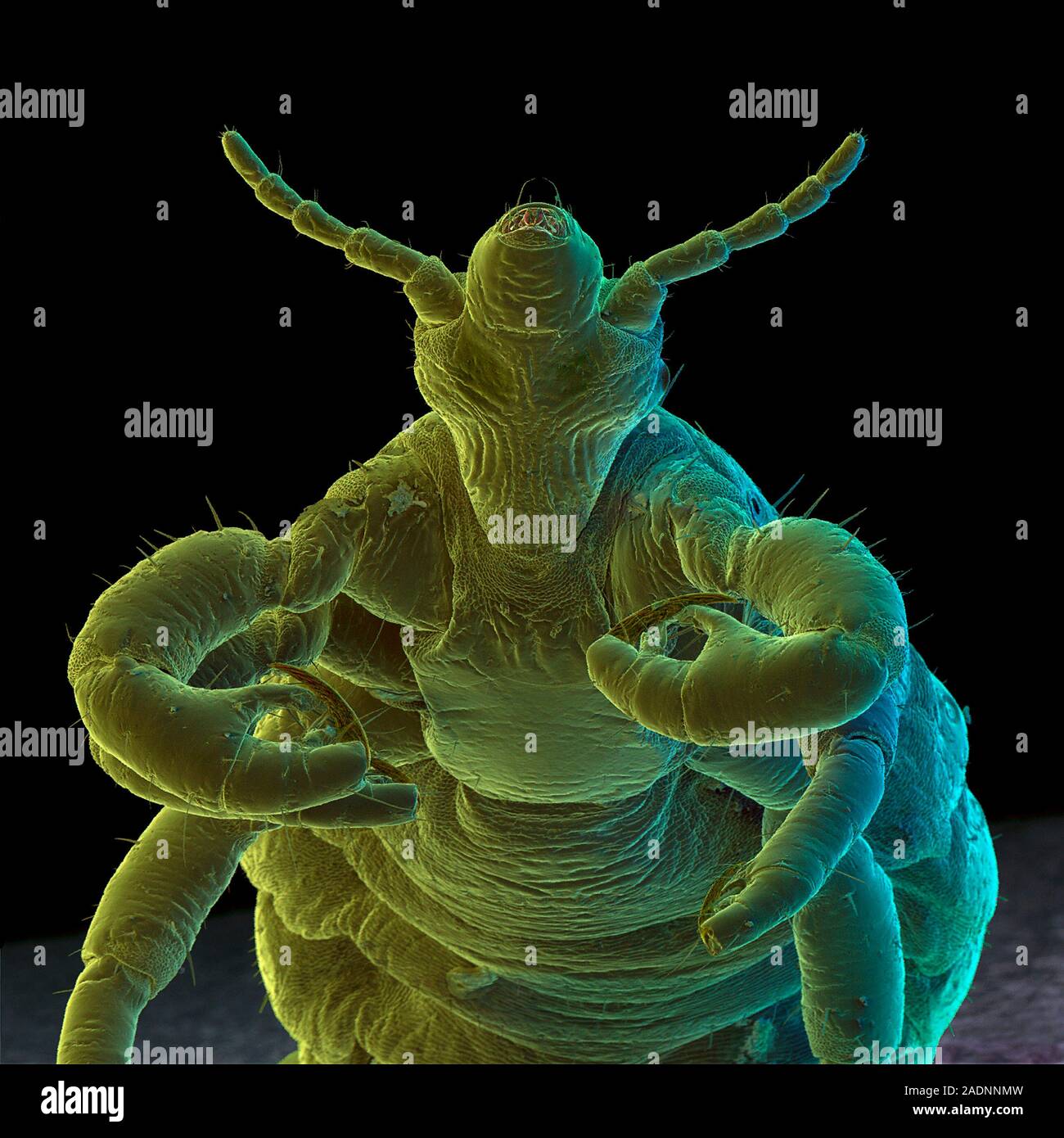 Body Louse Coloured Scanning Electron Micrograph SEM Of The Blood