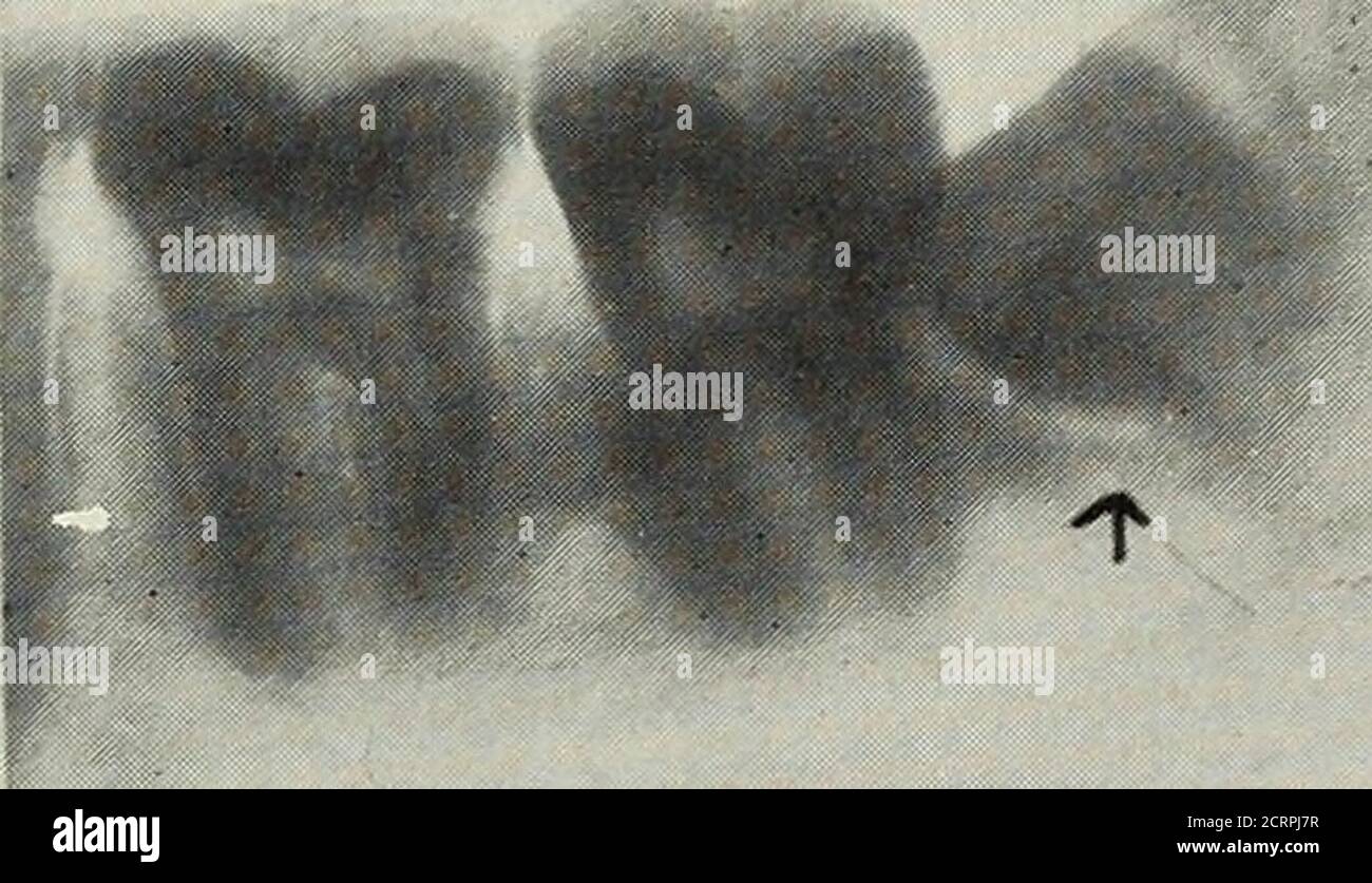 American Quarterly Of Roentgenology Ivio V Stock Photo Alamy