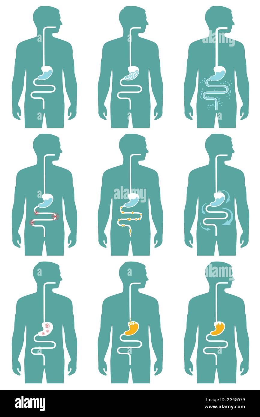 Human Digestive System Vector Illustration Of Digestion Tract Disease