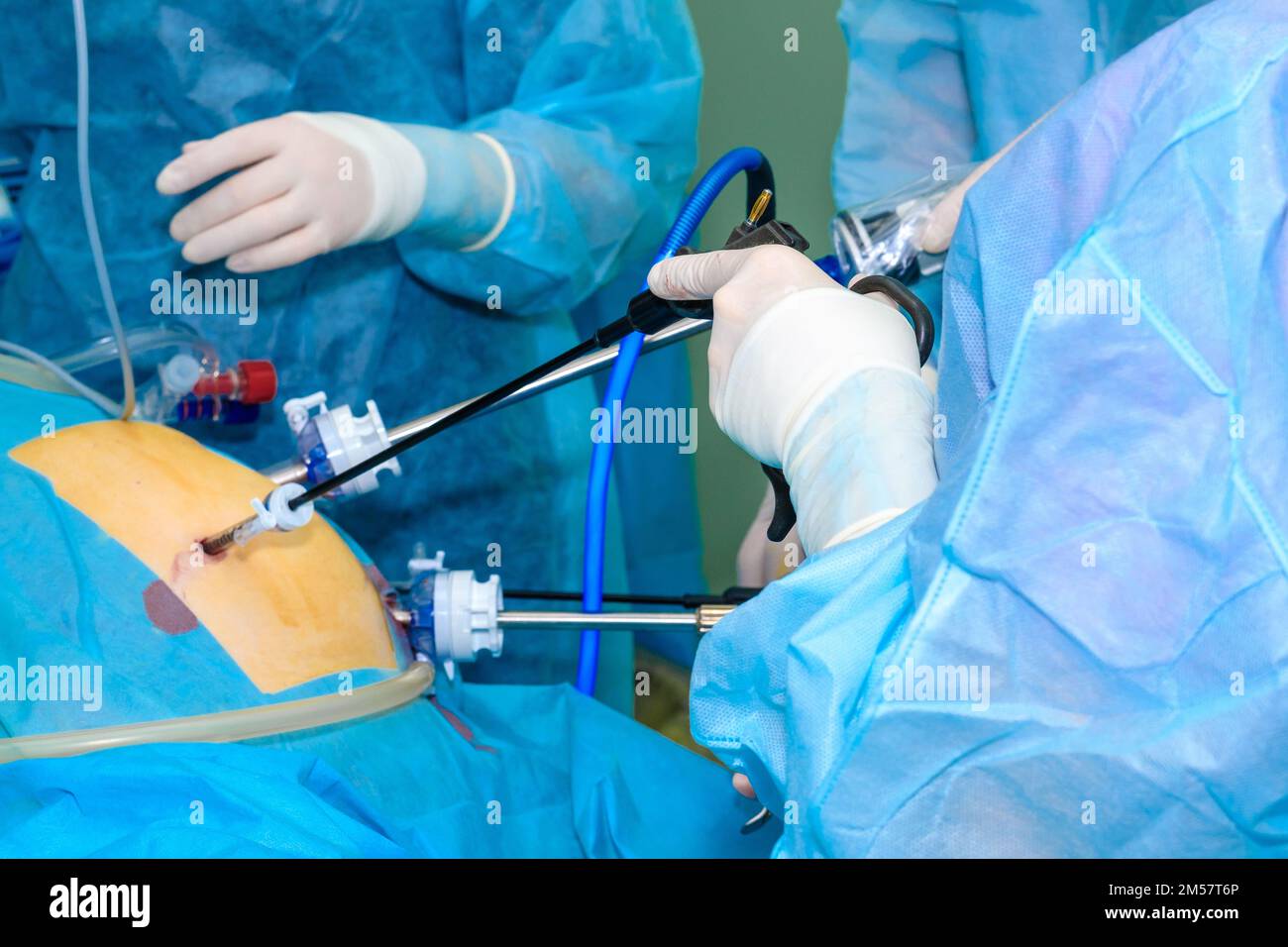 Laparoscopic Surgical Manipulators In The Hands Of Doctors During