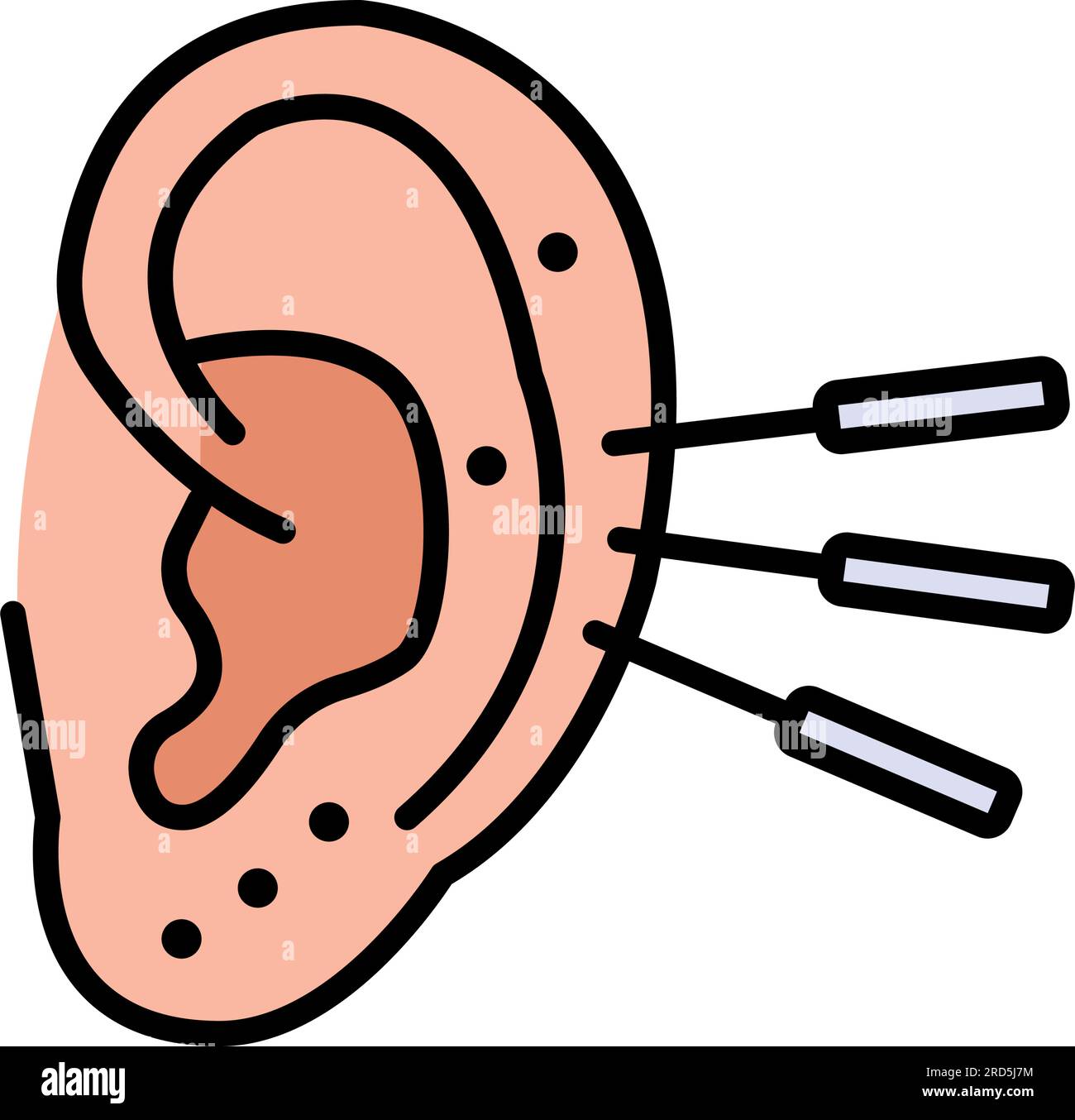 Non Surgical Ear Pinning Concept Ear Correction Or Earfold Creation