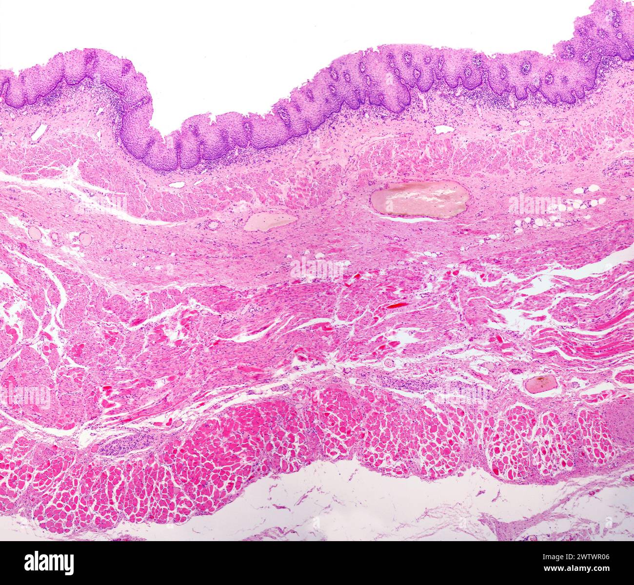 Light Micrograph Of Human Oesophagus Mucosa Showing The Lining Of