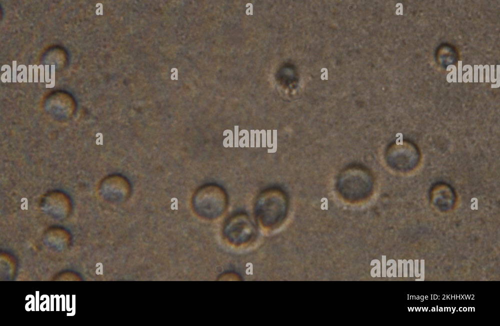 Microscopy Of Yeast Cells Saccharomyces Cerevisiae Magnification