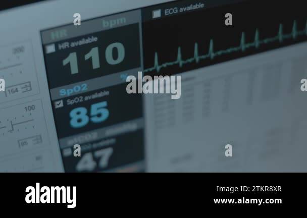 Close Up View Of The Screen Of Patient Monitor Displays Vital Signs Ecg