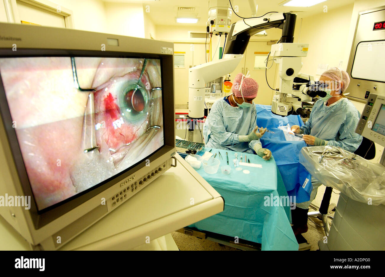 How do you find doctors that offer cataract operations for free?