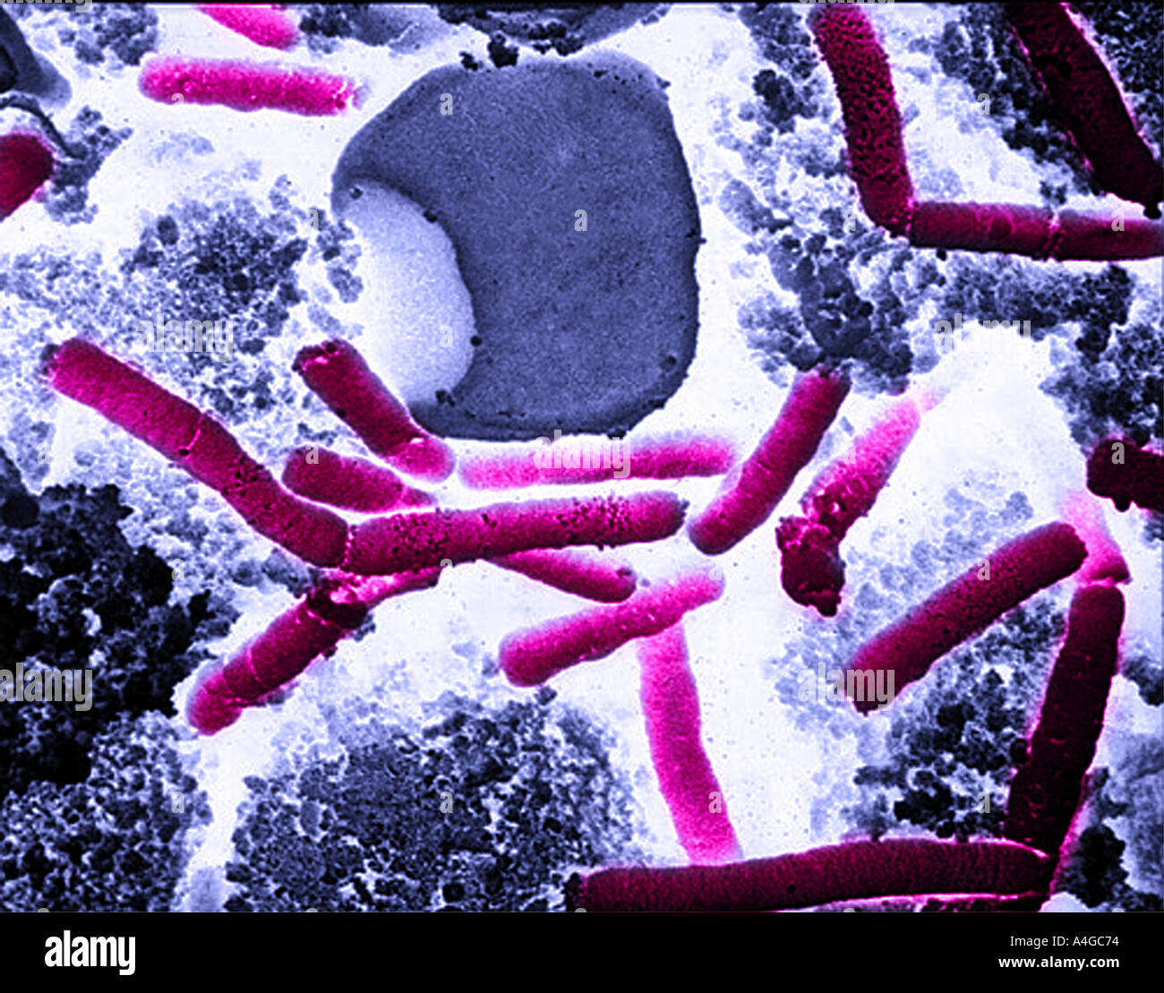 bacillus anthracis bacillus anthracis