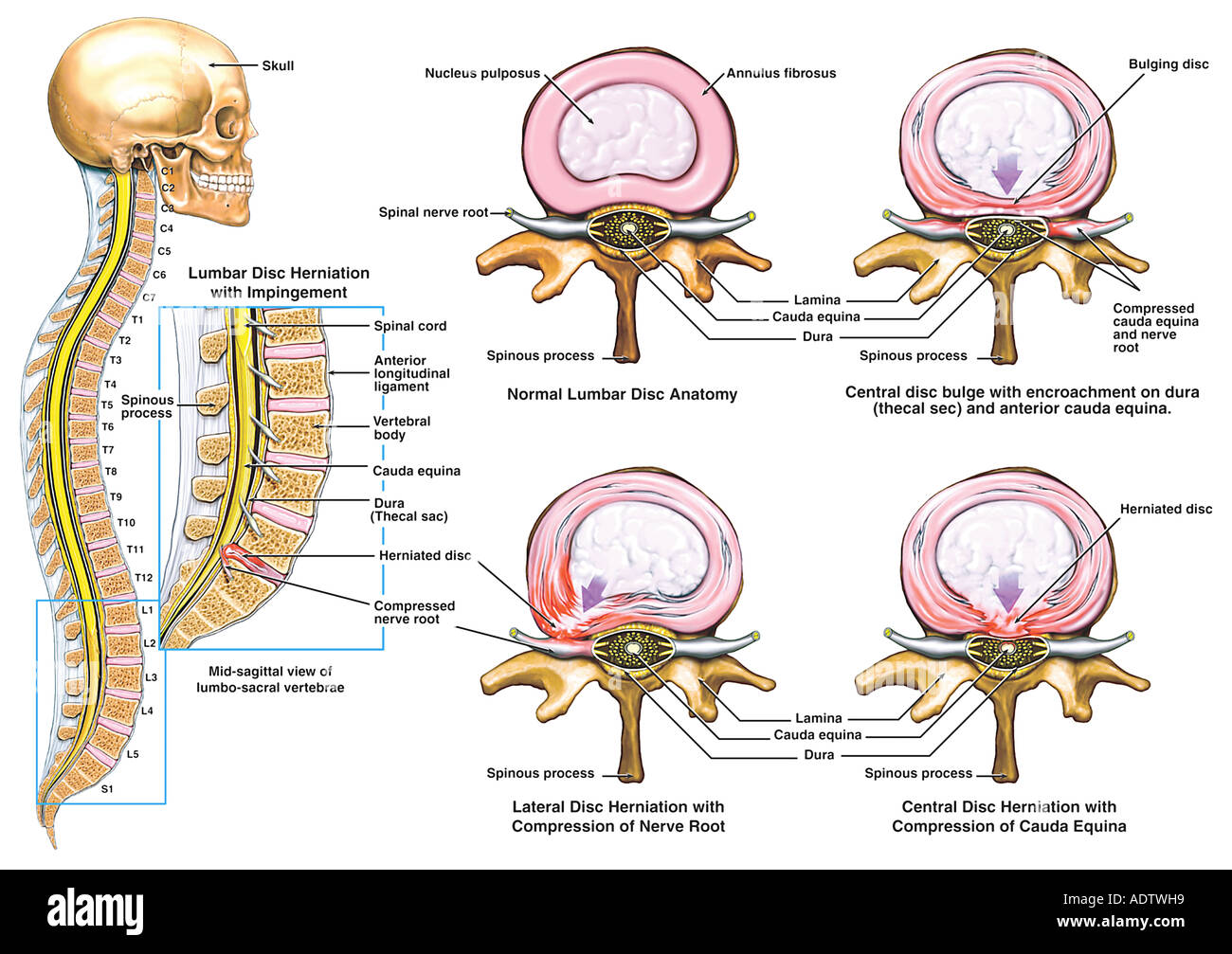 Herbs penetrate nerves spinal cord