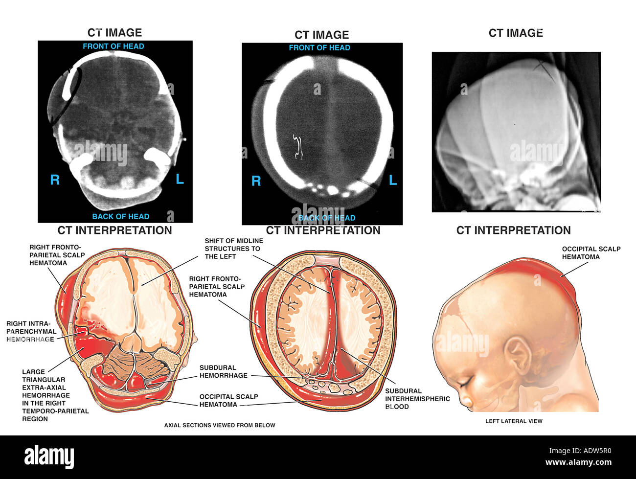 Do smart drugs make you smarter picture 1