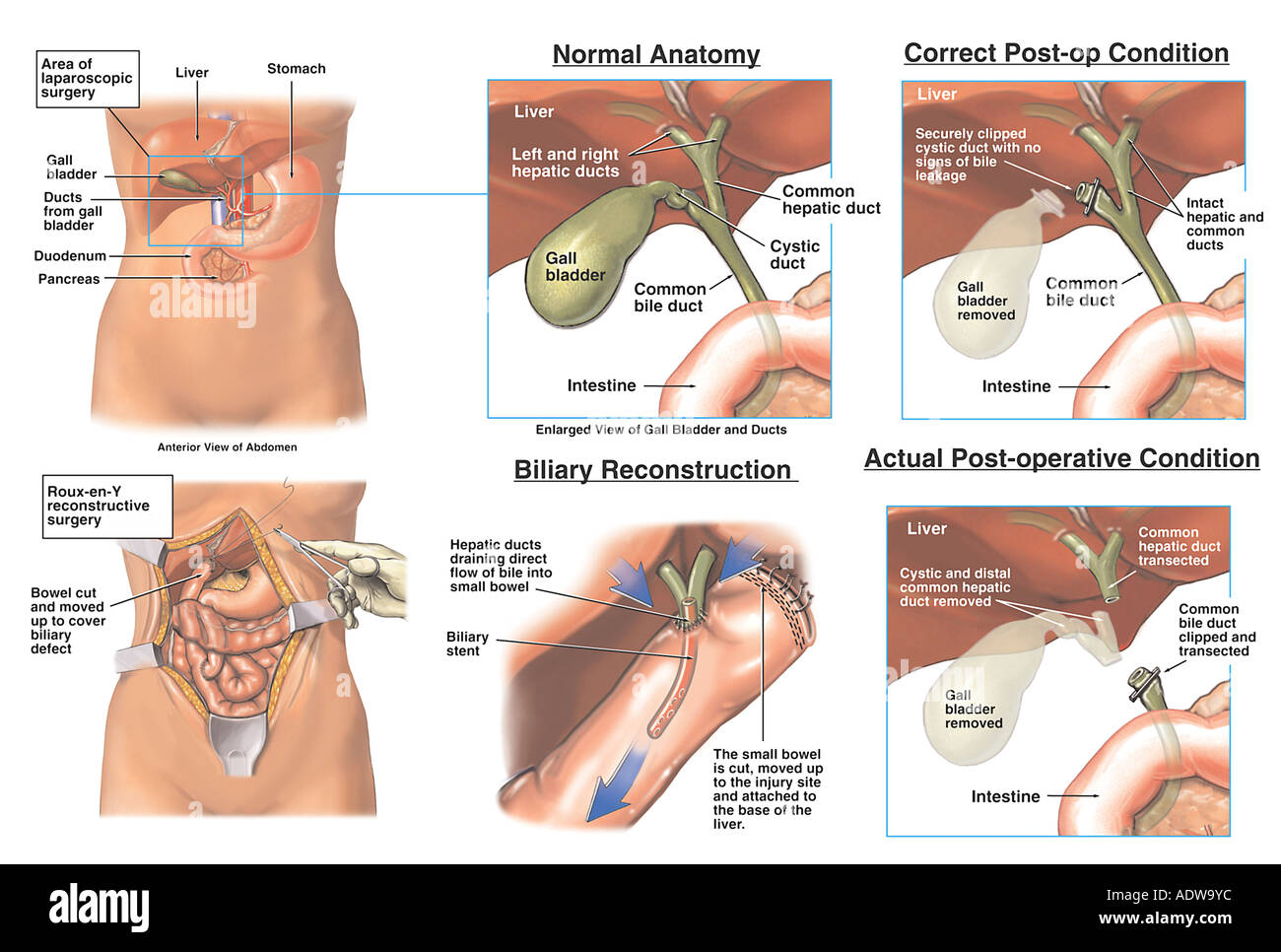 Vulva reconstruction surgery pictures