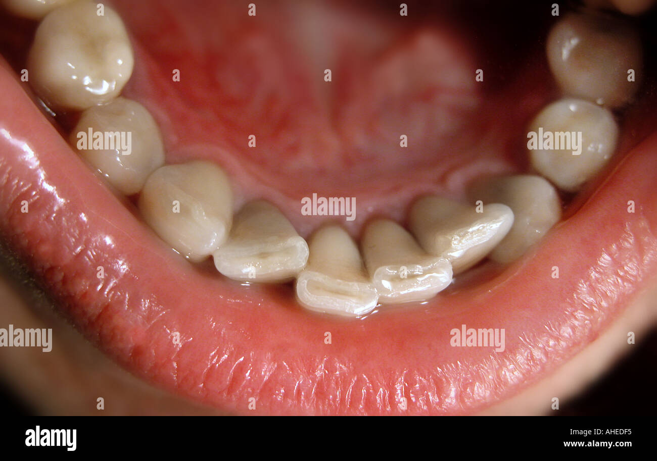 Inside The Mouth 24