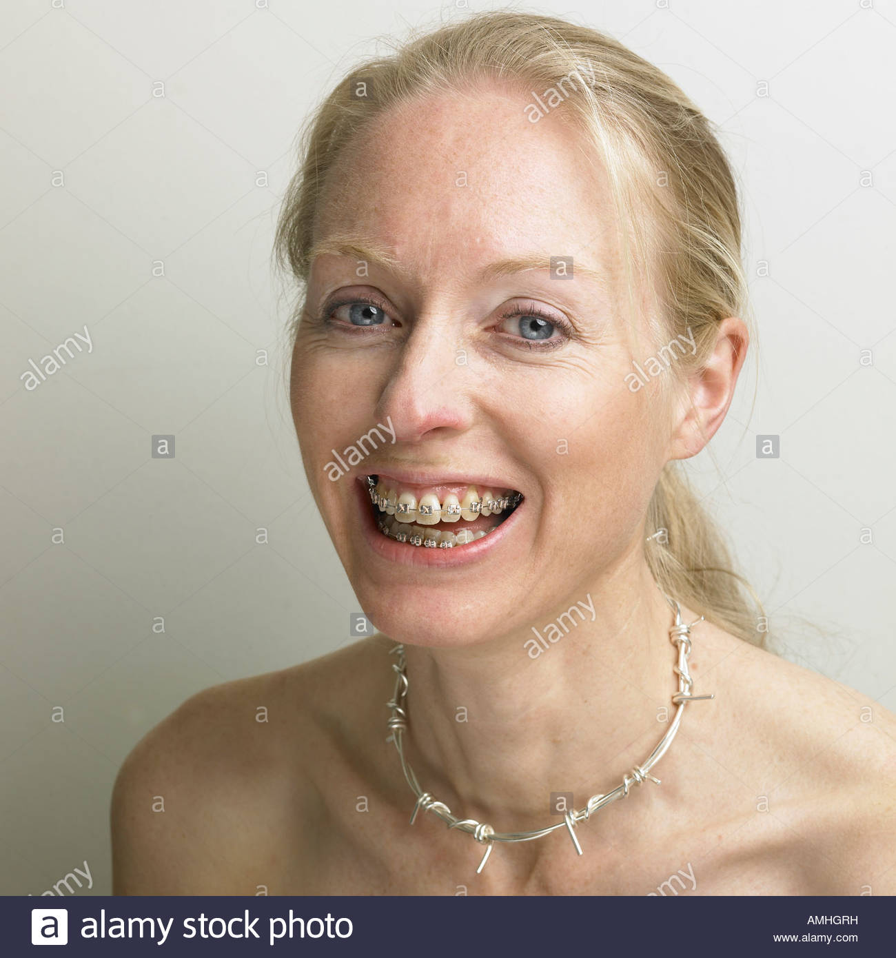 Free orthodontics for adults in alabama improbable Share free orthodontics for adults in alabama