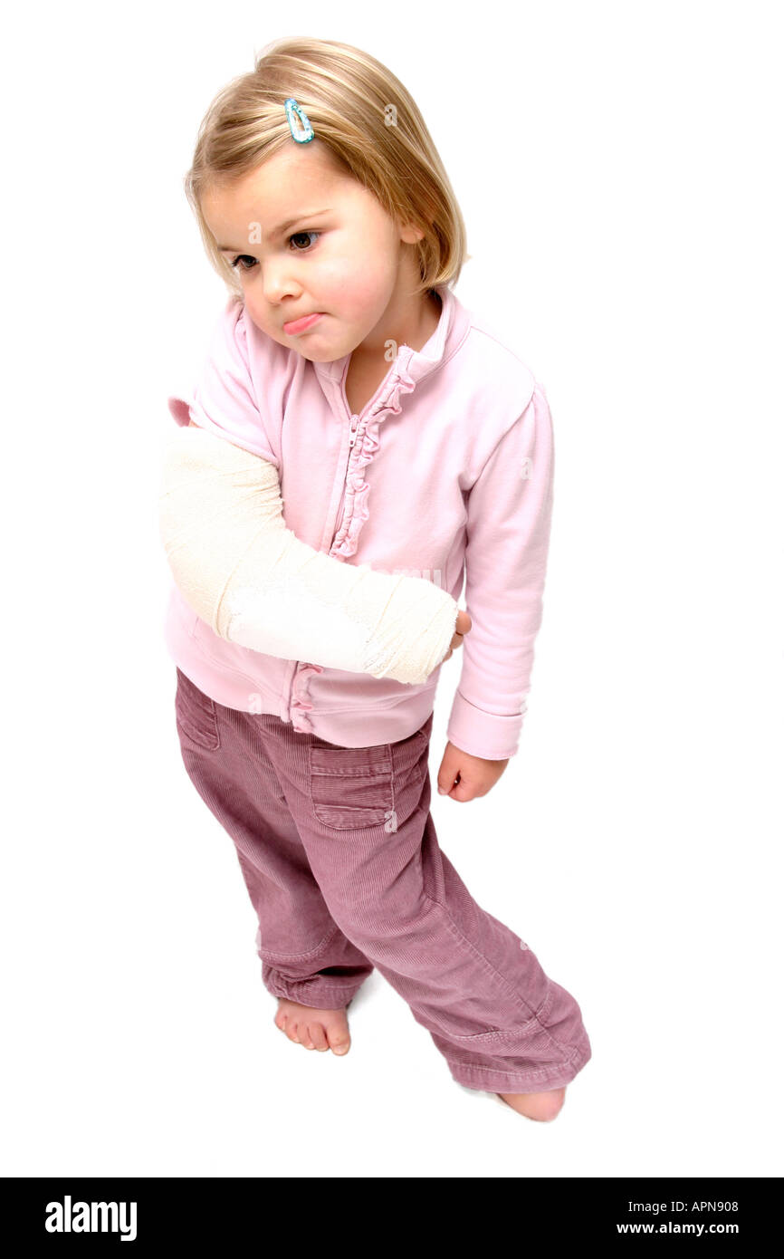 Child with Broken Arm Stock Photo, Royalty Free Image 2939143 Alamy