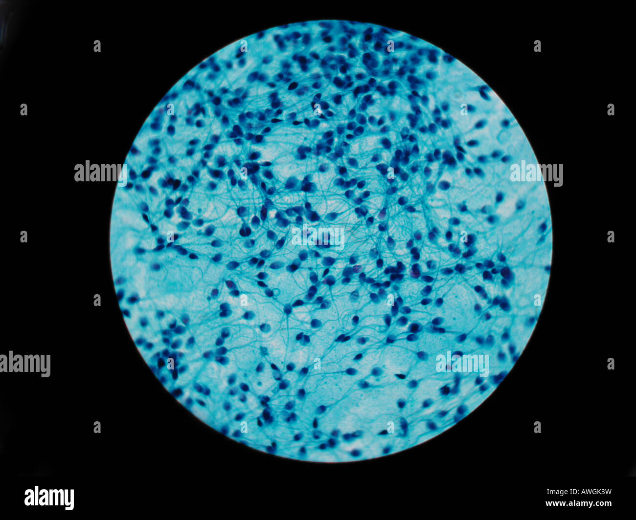 microscope images of stained sperm the boondocks porn gif