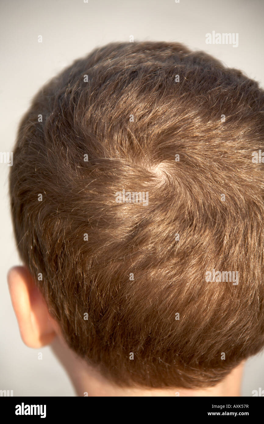 Swirl Spiral Pattern Of Hair On The Back Of A Young Boy Child S Head 