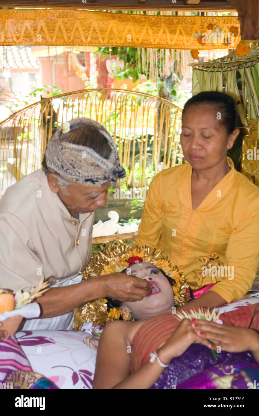 The tooth filing ceremony, in Bali (Indonesia). La cérémonie du Stock