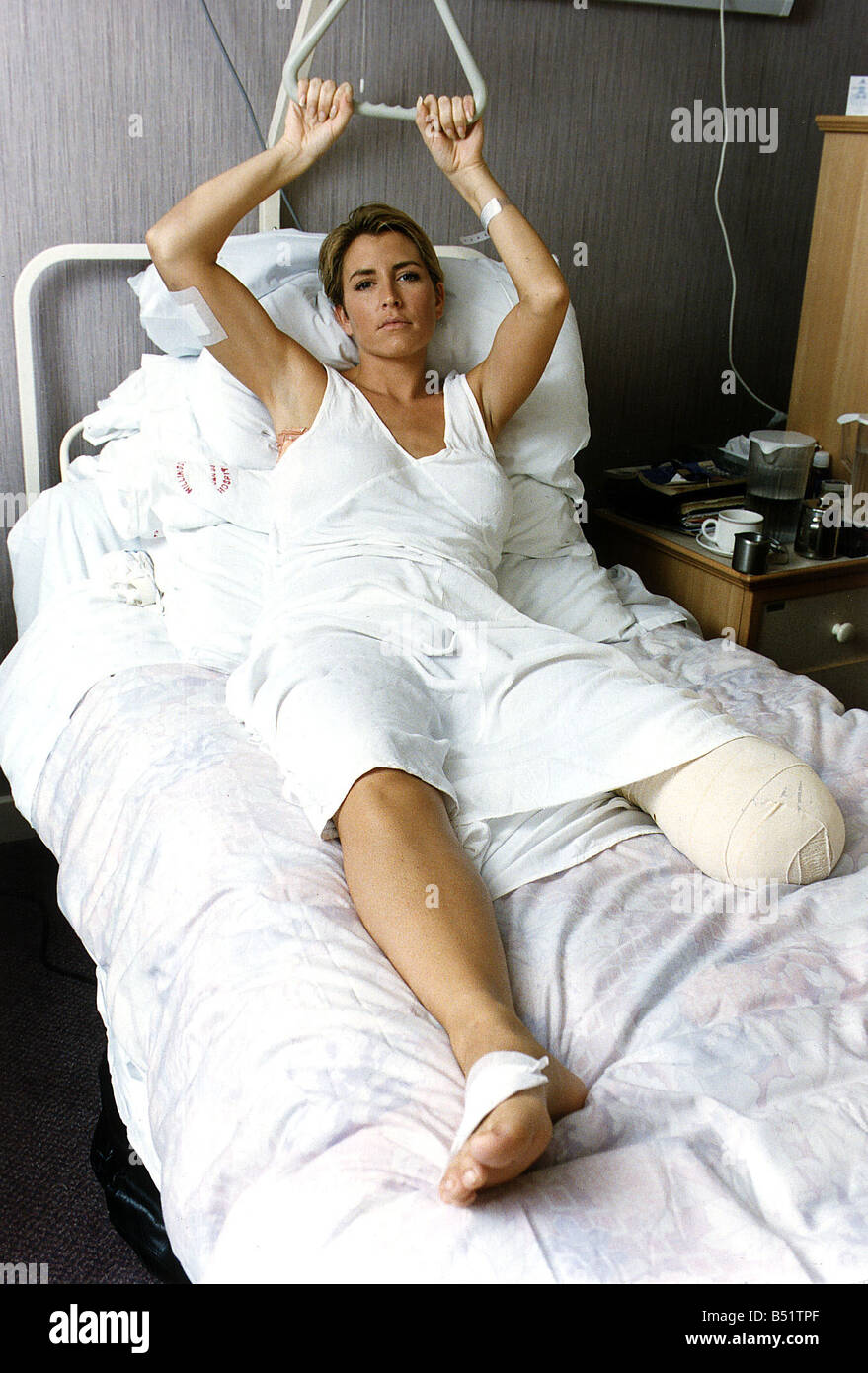 heather-mills-model-who-lost-her-leg-in-
