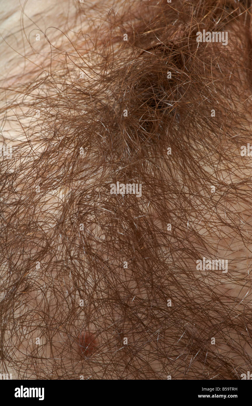 Pubic Hair 40