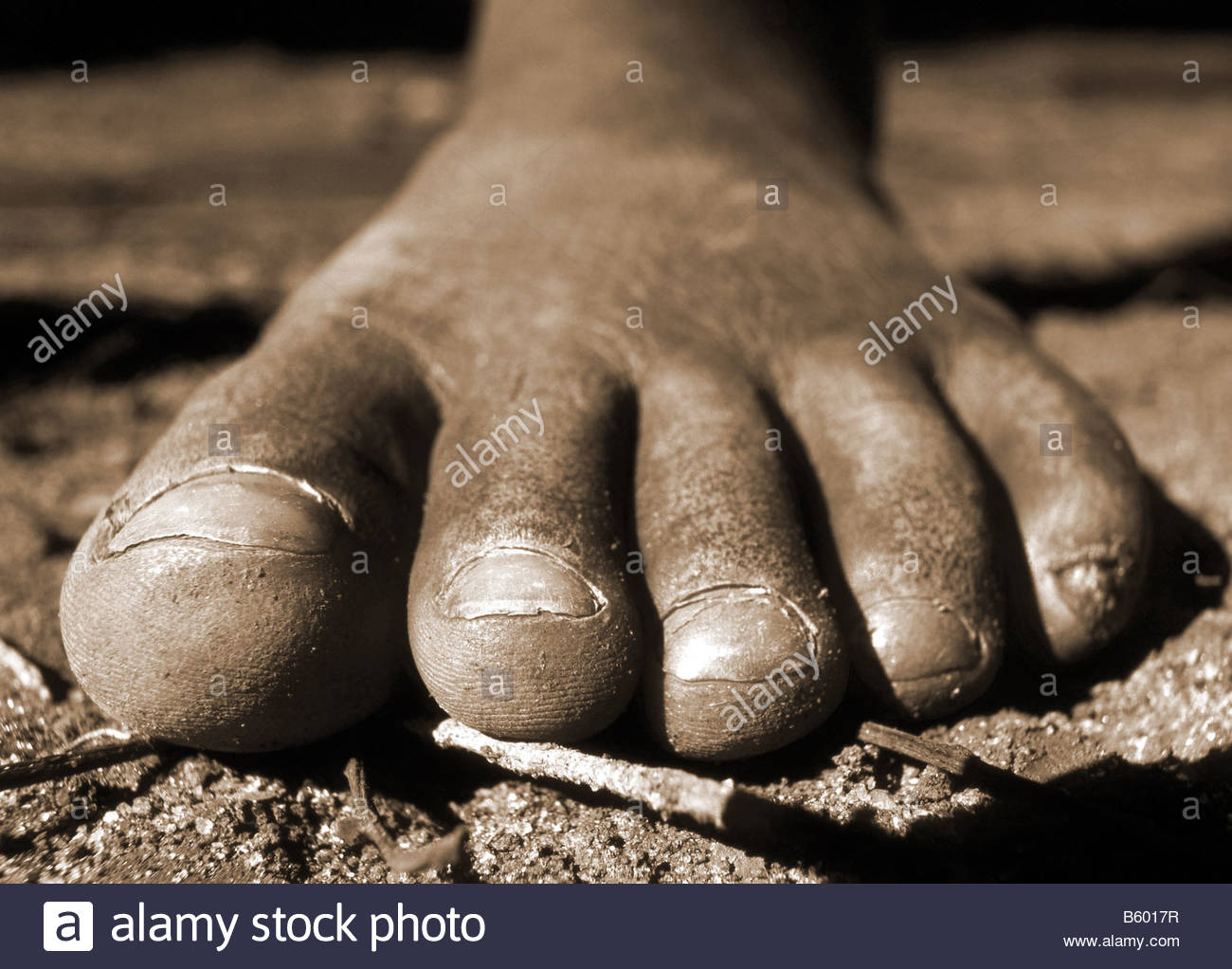 toe