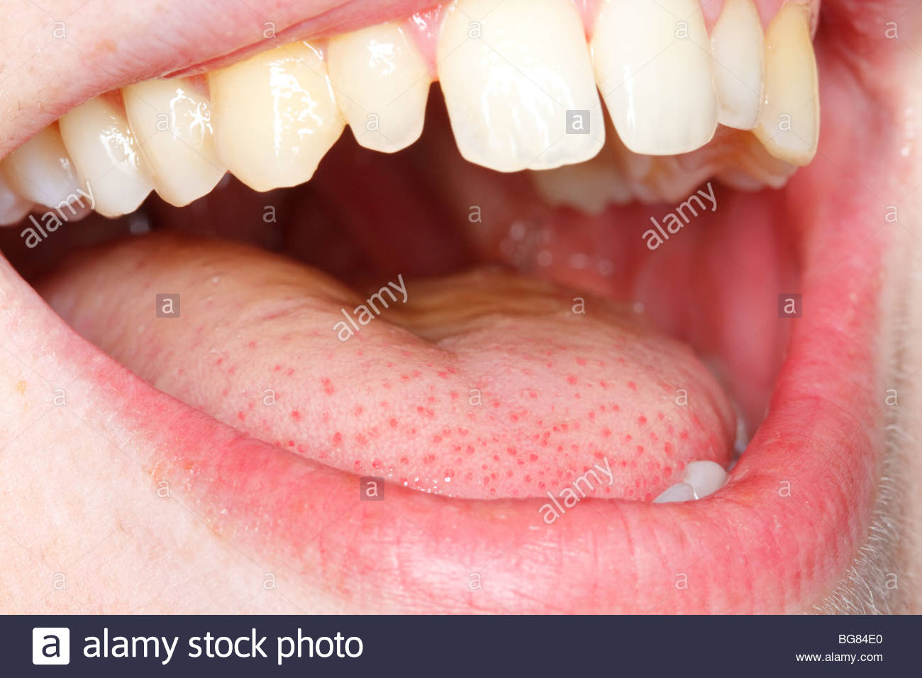 Close Up Pictures Of Human Tongue Papillae 120