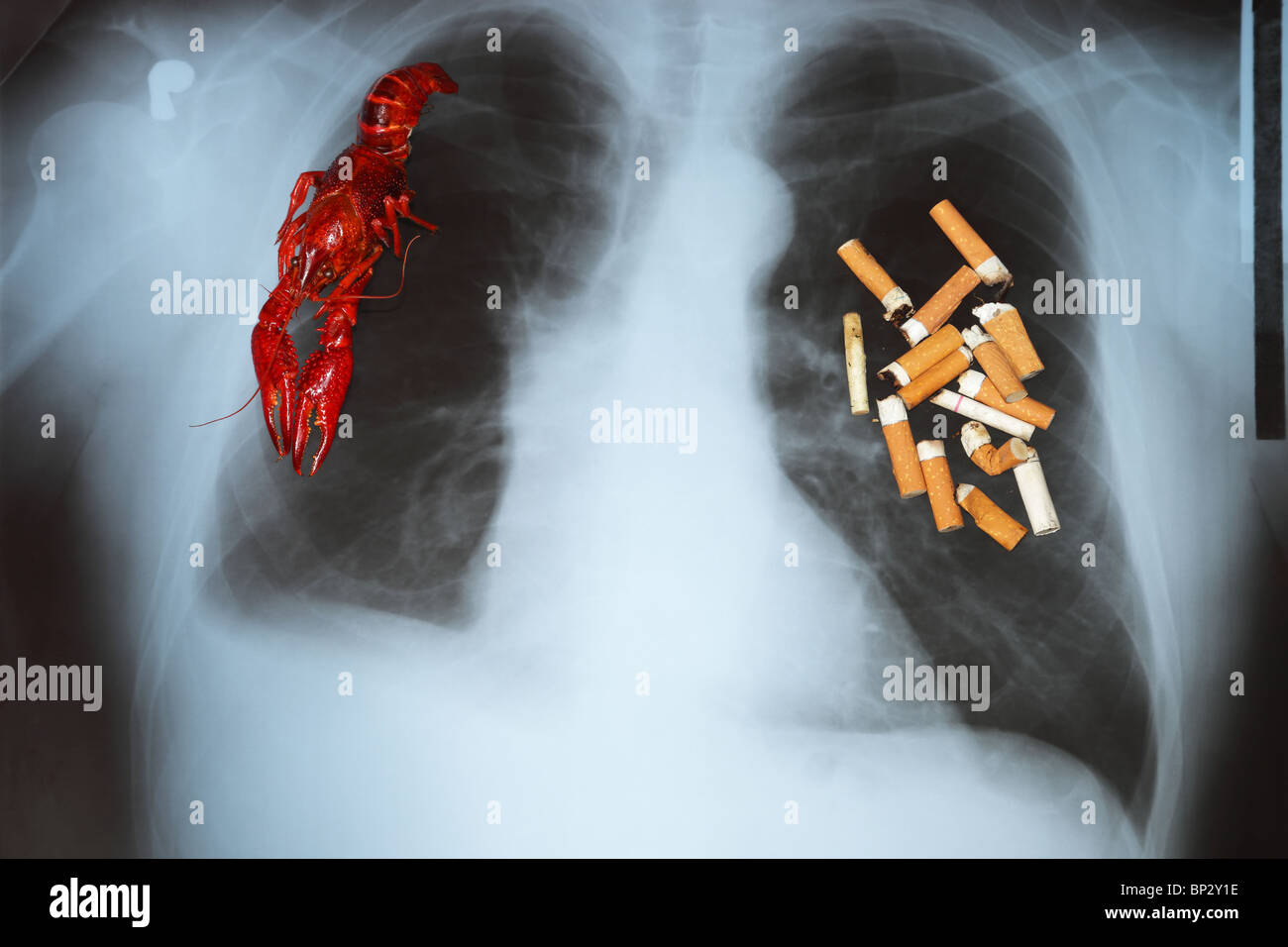 Effects of cigarette smoking lung cancer Stock Photo, Royalty Free Image 30797914 Alamy