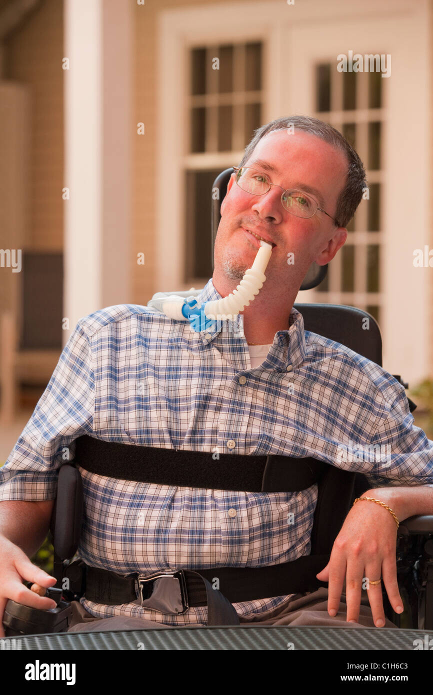 Man with Duchenne muscular dystrophy with a breathing ventilator Stock