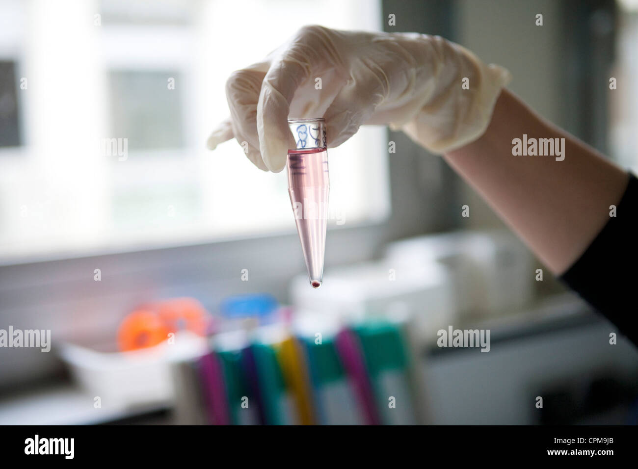 BLOOD ANALYSIS Stock Photo, Royalty Free Image 48389779 Alamy