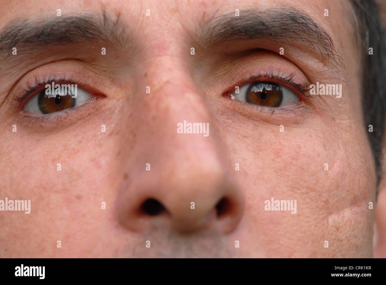 facial-scar-on-the-left-check-of-a-30-year-old-male-the-scar-was-caused-CRK1KR.jpg