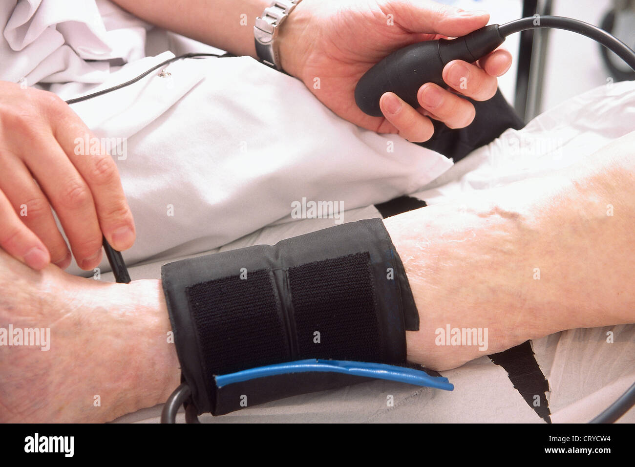 ankle-brachial index