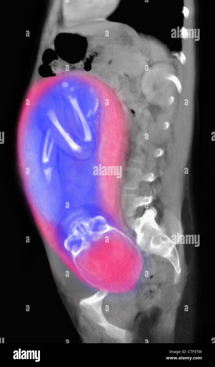 Sex Ct Scan 55