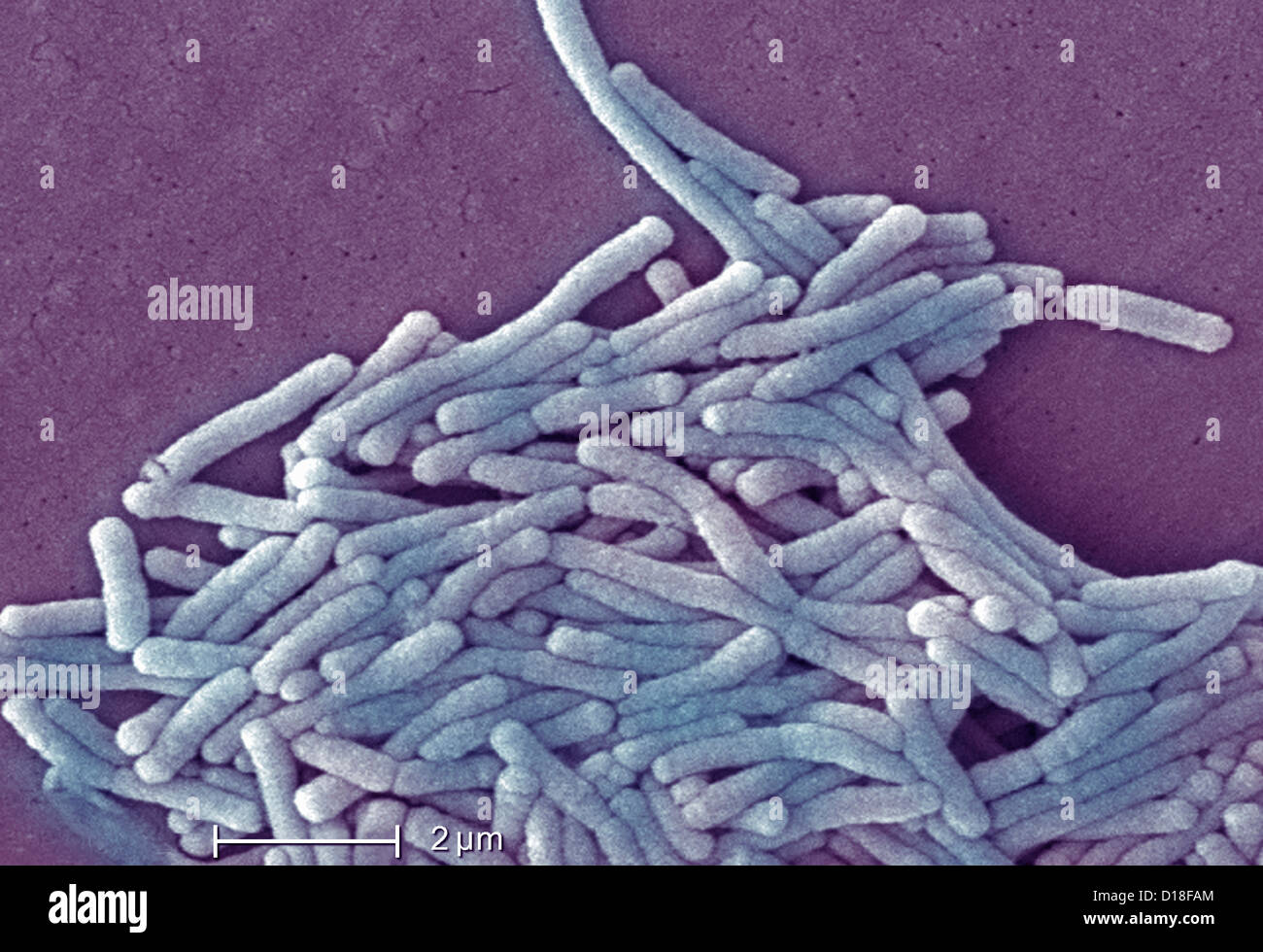 Electron micrograph of Legionella bacteria, 6500x Stock Photo, Royalty