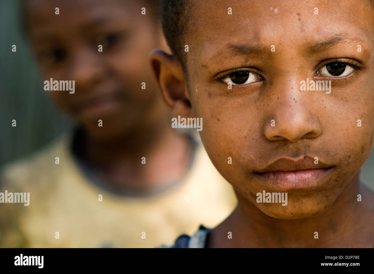 Poverty In Madagascar Hi Res Stock Photography And Images Alamy