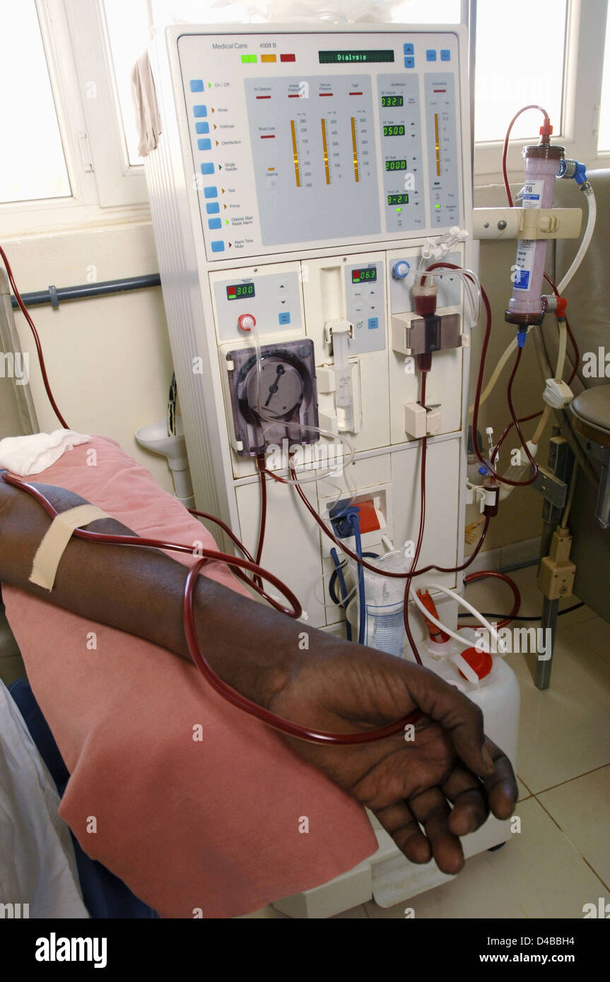 Patient arm attached to Hemodialysis Machine Stock Photo 54340304 Alamy