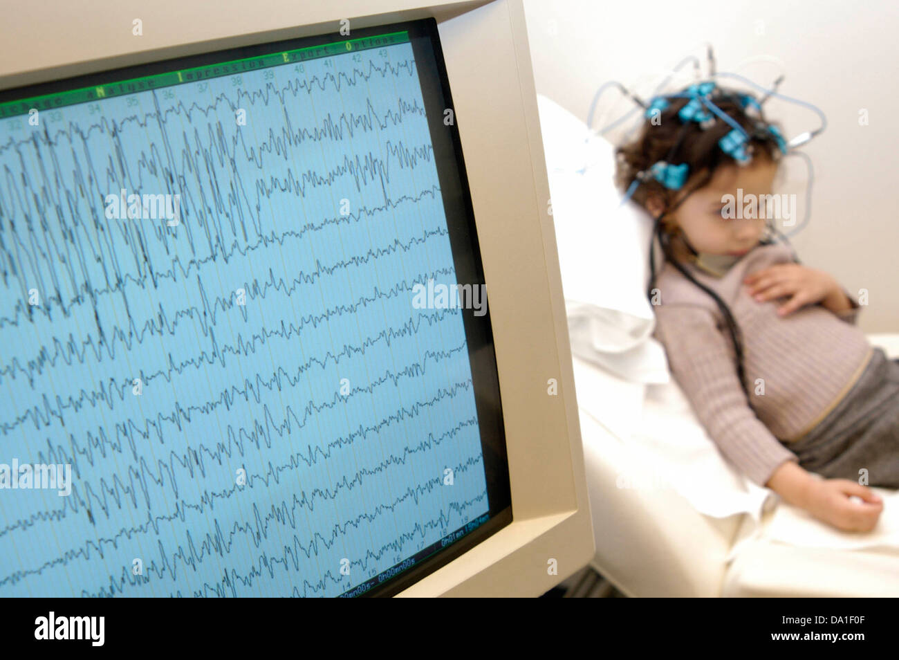EPILEPSY, EEG Stock Photo, Royalty Free Image 57811391 Alamy