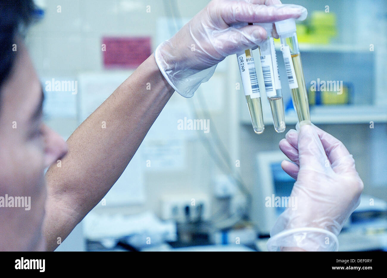 Urine samples to analyze at laboratory of hospital Stock Photo, Royalty